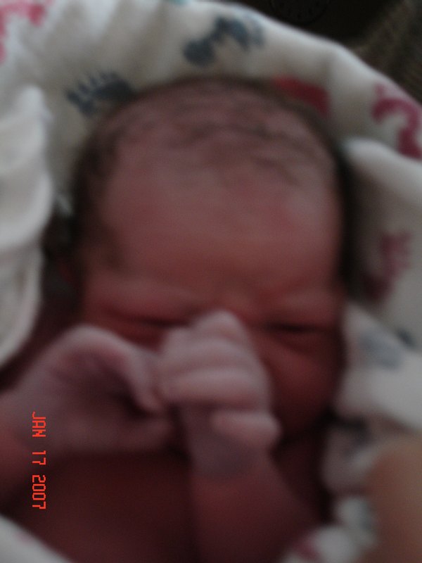 It's quite the traumatic thing for the poor baby