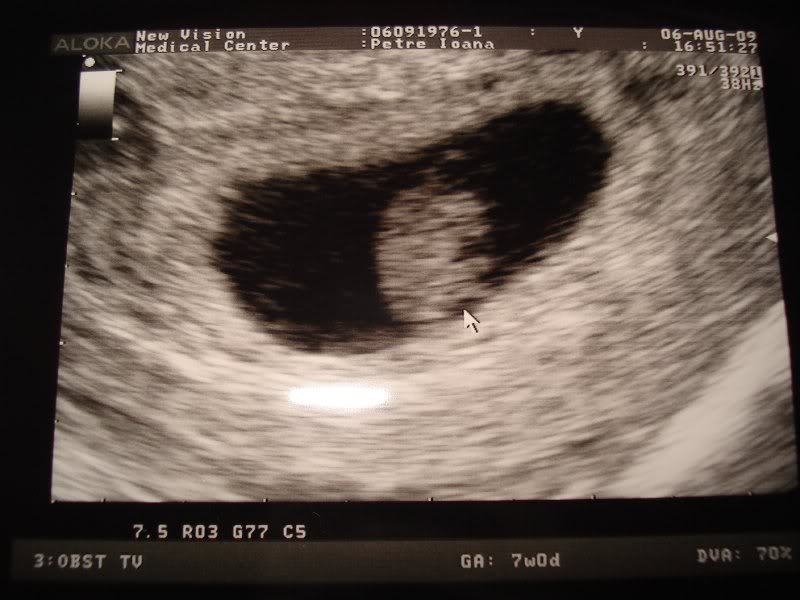 7 sapt - se vede bebe!!