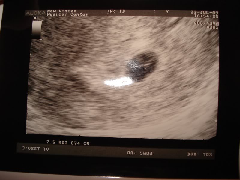 la inceput s-a vazut unul..