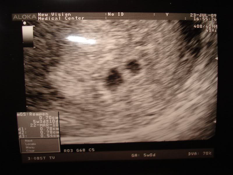 si apoi..surpriza! !