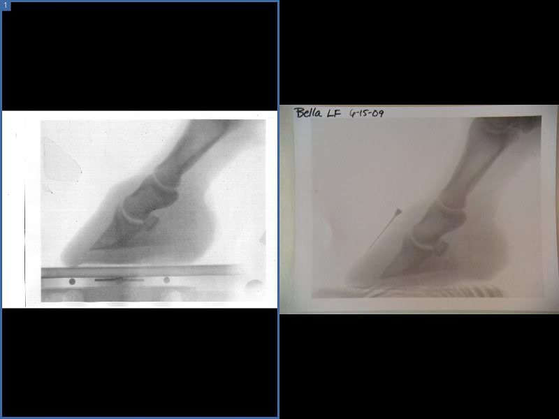 bella before and after LF rads