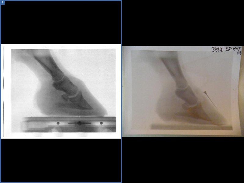 bella before and after RF rads